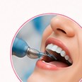 Dental Scaling + Polishing